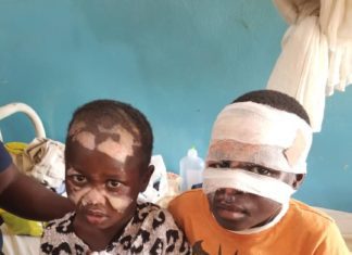 Two female minors accused of witchcraft set ablaze in Shen, Jos