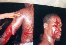 15 people injured in kingship tussle in Uzere, Delta state