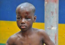 Police in Enugu arrest child molester who pressed hot iron on minor