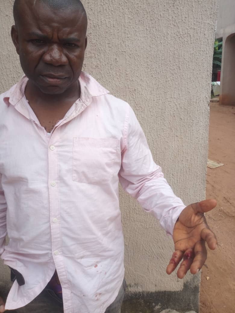 Armed Immigration Officers attached to ACG Zone 'D' manhandle man in Awka over breach of contract